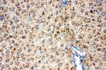 DLD Antibody in Immunohistochemistry (Paraffin) (IHC (P))