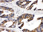 DLD Antibody in Immunohistochemistry (Paraffin) (IHC (P))