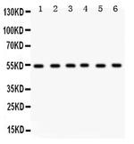 DLD Antibody in Western Blot (WB)