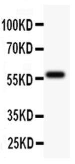 TdT Antibody in Western Blot (WB)