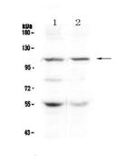 DPYD Antibody in Western Blot (WB)