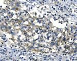 Desmoglein 2 (DSG2) Antibody in Immunohistochemistry (Paraffin) (IHC (P))