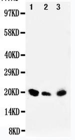 DUSP3 Antibody in Western Blot (WB)