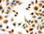 DCI Antibody in Immunocytochemistry (ICC/IF)