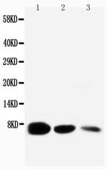 EGF Antibody in Western Blot (WB)