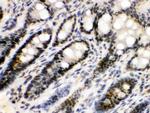 EME1 Antibody in Immunohistochemistry (Paraffin) (IHC (P))