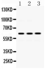 EME1 Antibody in Western Blot (WB)