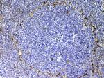 CD105 (Endoglin) Antibody in Immunohistochemistry (Paraffin) (IHC (P))