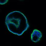 EpCAM (CD326) Antibody in Immunohistochemistry (Paraffin) (IHC (P))