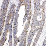 EphA1 Antibody in Immunohistochemistry (Paraffin) (IHC (P))