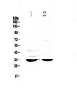 ERCC1 Antibody in Western Blot (WB)