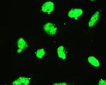 EWSR1 Antibody in Immunocytochemistry (ICC/IF)