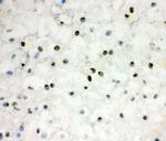 EWSR1 Antibody in Immunohistochemistry (Frozen) (IHC (F))