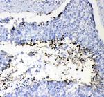 Prothrombin Antibody in Immunohistochemistry (Paraffin) (IHC (P))