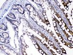 FABP2 Antibody in Immunohistochemistry (Paraffin) (IHC (P))