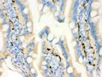 FABP4 Antibody in Immunohistochemistry (Paraffin) (IHC (P))