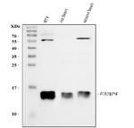 FABP4 Antibody in Western Blot (WB)