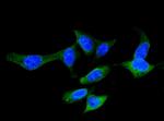 FABP5 Antibody in Immunocytochemistry (ICC/IF)