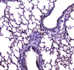 FABP5 Antibody in Immunohistochemistry (Paraffin) (IHC (P))