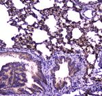 FABP5 Antibody in Immunohistochemistry (Paraffin) (IHC (P))