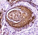 FABP5 Antibody in Immunohistochemistry (Paraffin) (IHC (P))