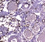 FABP5 Antibody in Immunohistochemistry (Paraffin) (IHC (P))