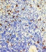 FAS (CD95) Antibody in Immunohistochemistry (Paraffin) (IHC (P))