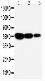 FAS (CD95) Antibody in Western Blot (WB)