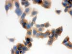 FASN Antibody in Immunocytochemistry (ICC/IF)