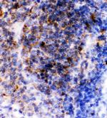 CD23 Antibody in Immunohistochemistry (Paraffin) (IHC (P))