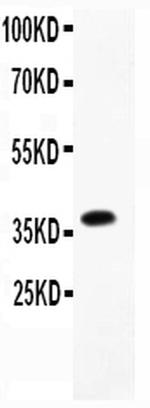 CD23 Antibody in Western Blot (WB)