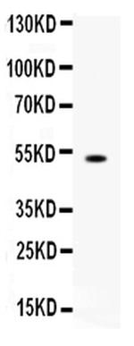 FCGRT Antibody in Western Blot (WB)