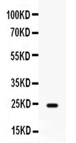 FGF1 Antibody in Western Blot (WB)