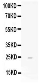 FGF19 Antibody in Western Blot (WB)