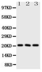 FGF21 Antibody in Western Blot (WB)