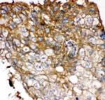 FGFR4 Antibody in Immunohistochemistry (Paraffin) (IHC (P))