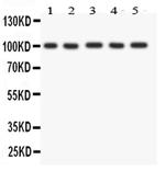 FGFR4 Antibody in Western Blot (WB)