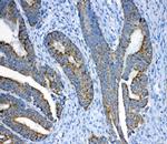 Fumarase Antibody in Immunohistochemistry (Paraffin) (IHC (P))