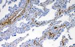 VEGFD Antibody in Immunohistochemistry (Paraffin) (IHC (P))