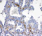 VEGFD Antibody in Immunohistochemistry (Paraffin) (IHC (P))