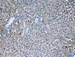 FLT3 (CD135) Antibody in Immunohistochemistry (Paraffin) (IHC (P))