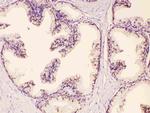 GAA Antibody in Immunohistochemistry (Paraffin) (IHC (P))