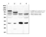 GAA Antibody in Western Blot (WB)