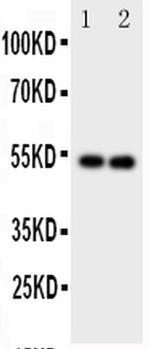 GABRA1 Antibody in Western Blot (WB)