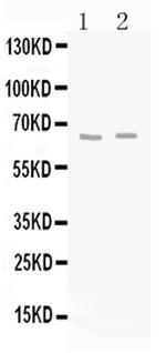 GAD65 Antibody in Western Blot (WB)