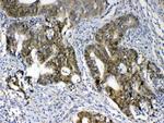 GALE Antibody in Immunohistochemistry (Paraffin) (IHC (P))