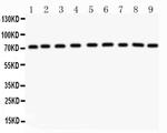 Growth Hormone Receptor Antibody in Western Blot (WB)