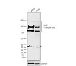 GLI2 Antibody in Western Blot (WB)