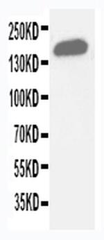 GLI2 Antibody in Western Blot (WB)