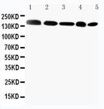 GLI2 Antibody in Western Blot (WB)